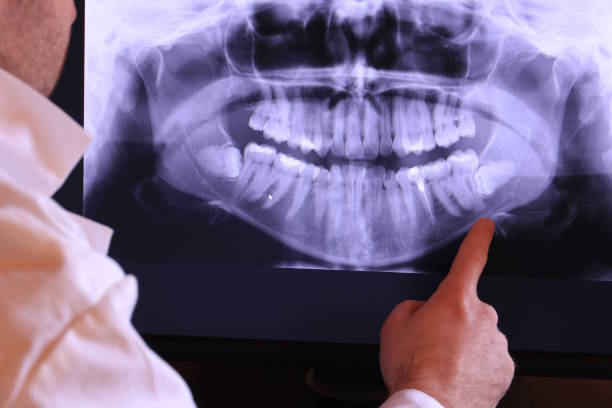  Allentown, NJ Emergency Dentist Pros